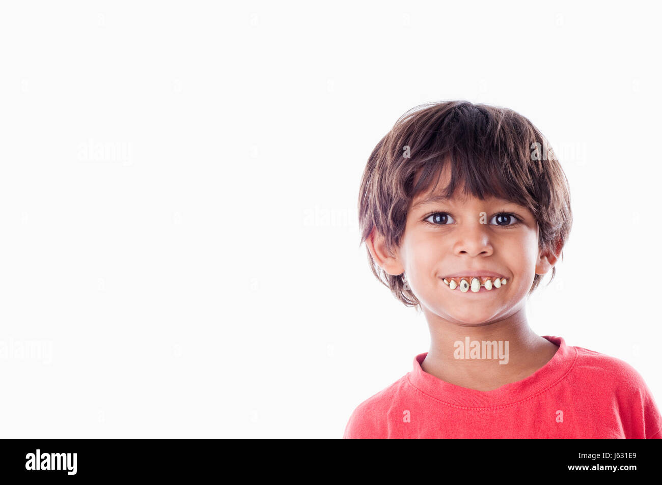 tooth false position boy lad male youngster child head optional teeth face Stock Photo