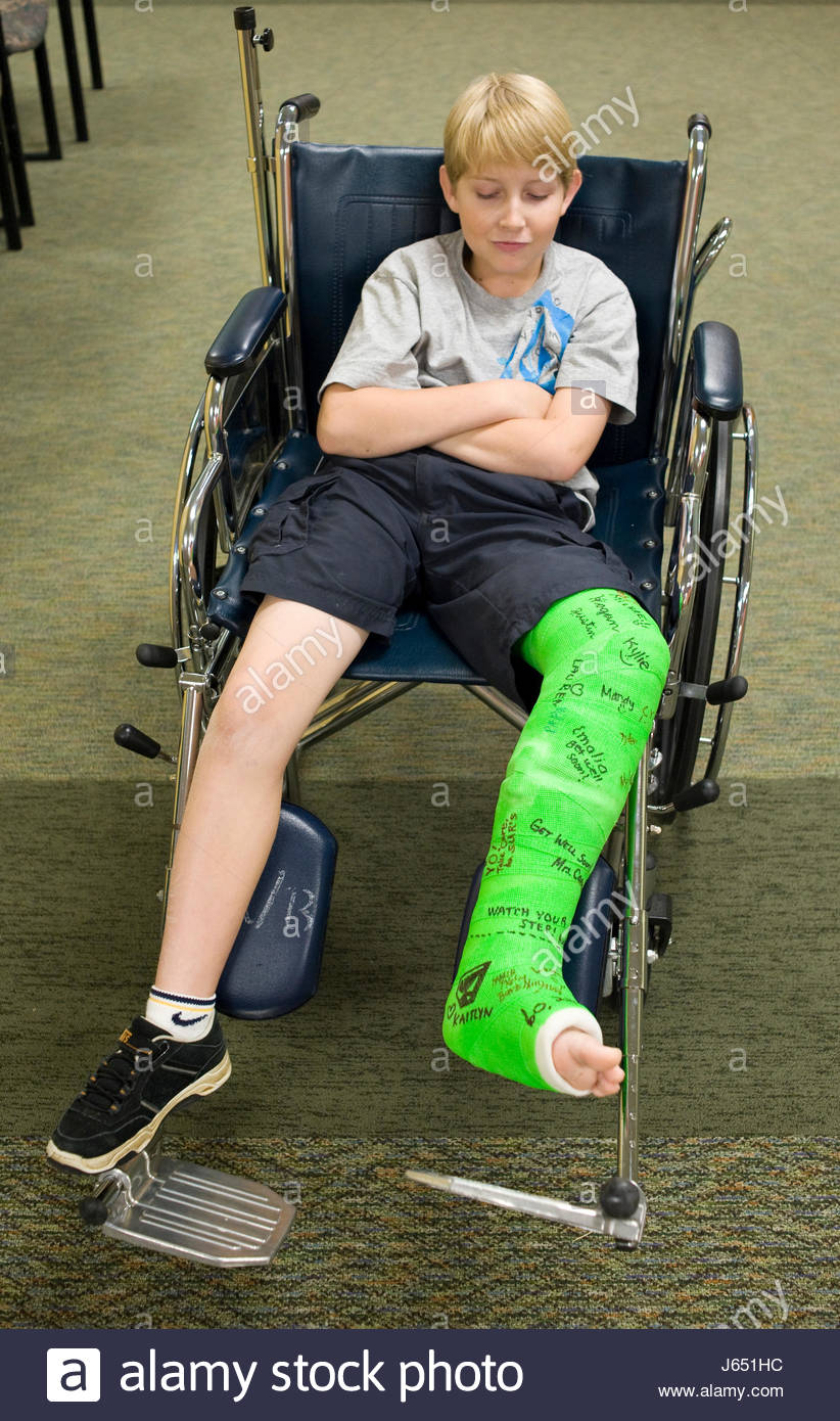 Boy Child With Broken Leg High Resolution Stock Photography and Images