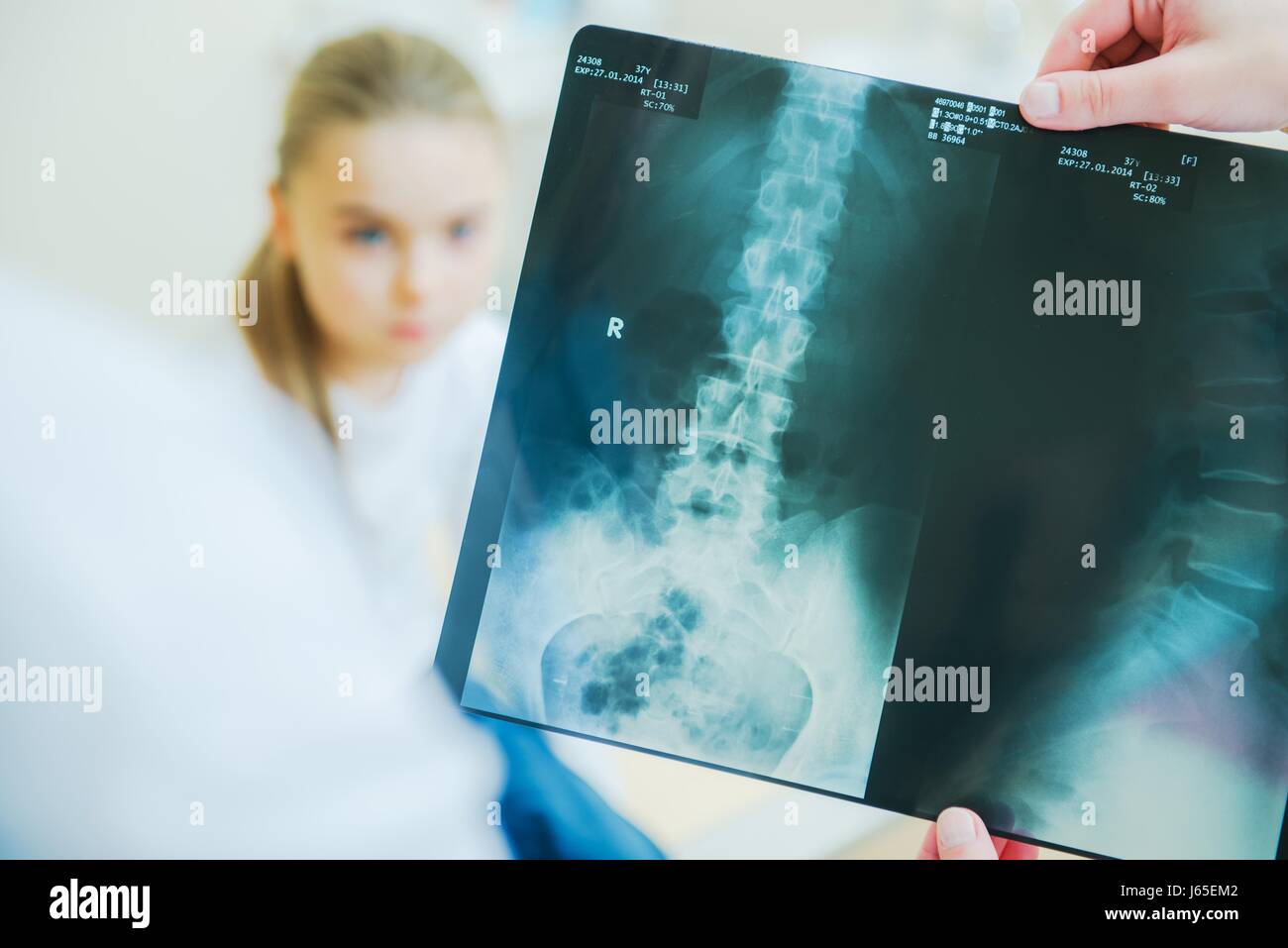 Children Xray Scanning Concept Photo with X Ray Imagery and Little Girl