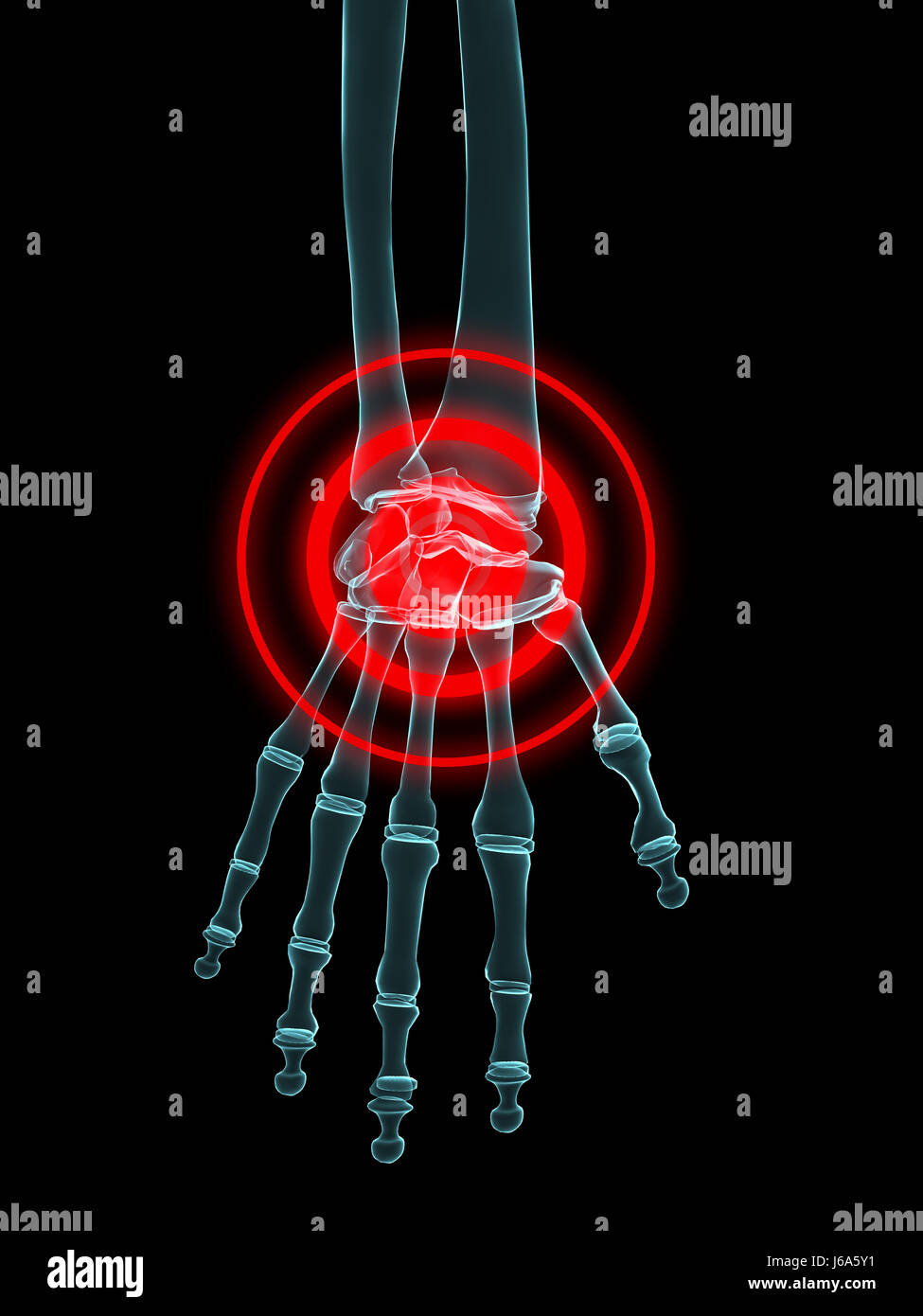 hand ache joint bones fingers rheumatism health medicinally medical