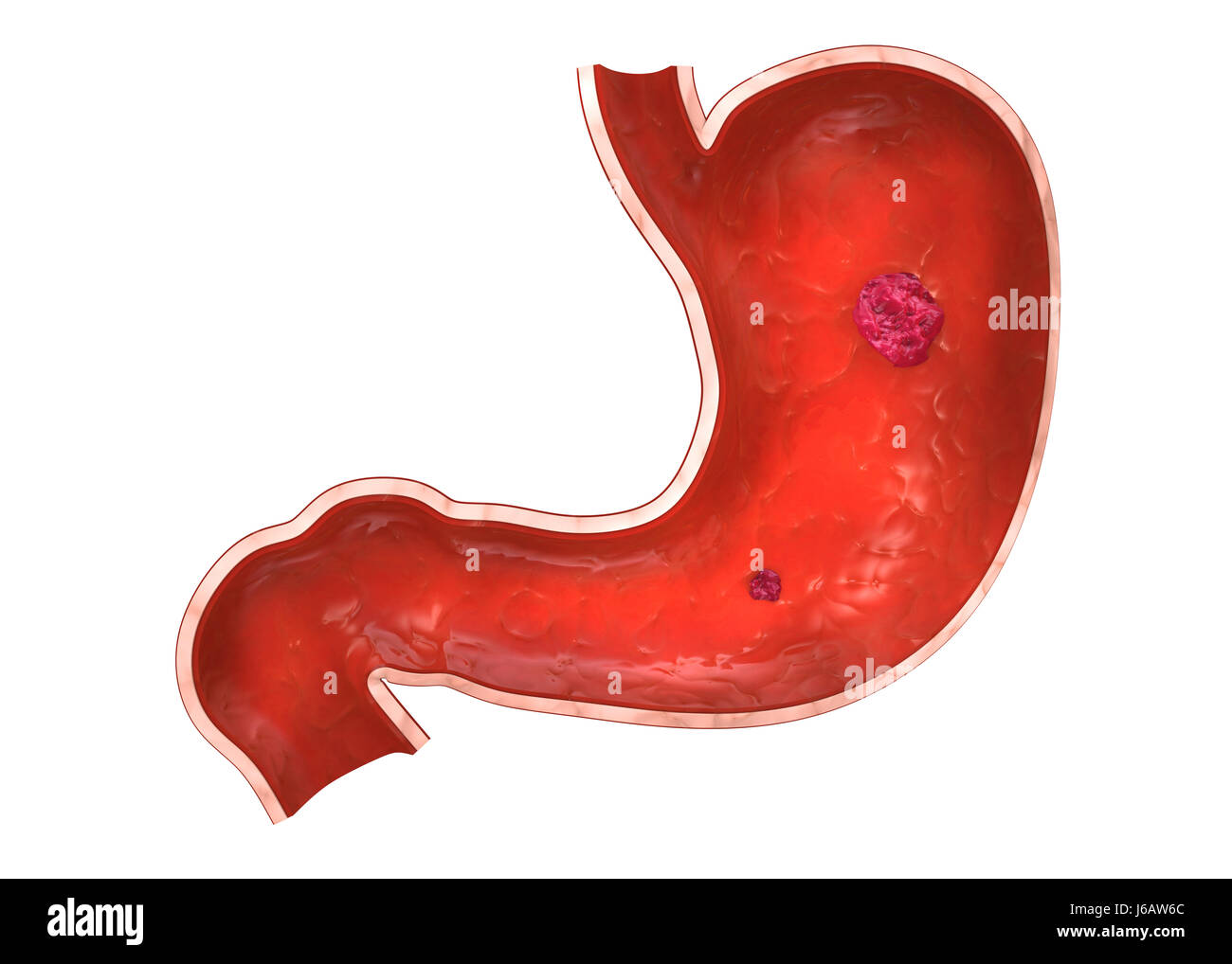 health medicinally medical human human being belly tummy ache digestion anatomy Stock Photo