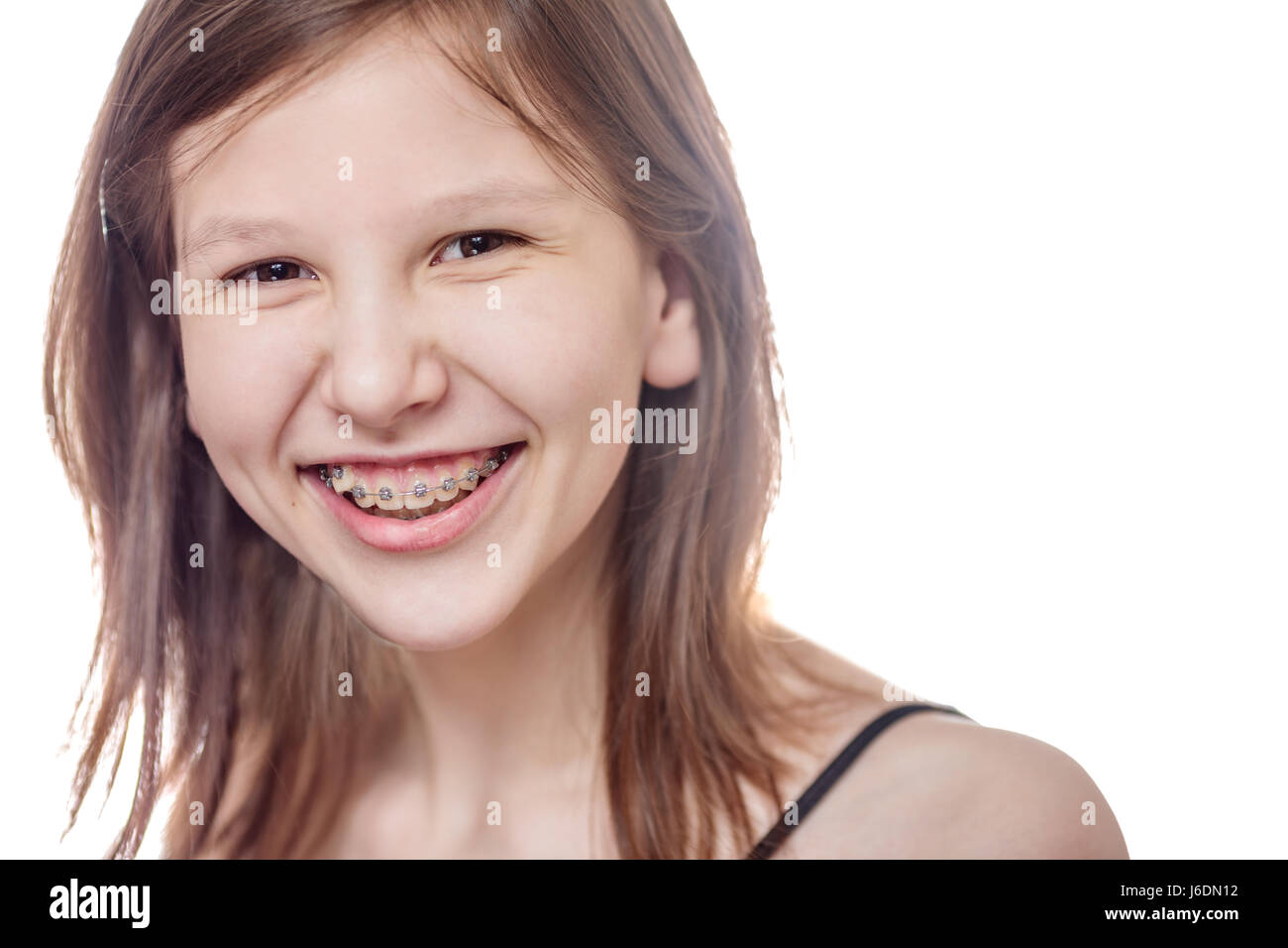 Laughing teen girl wearing braces looking at camera isolated on white Stock  Photo - Alamy