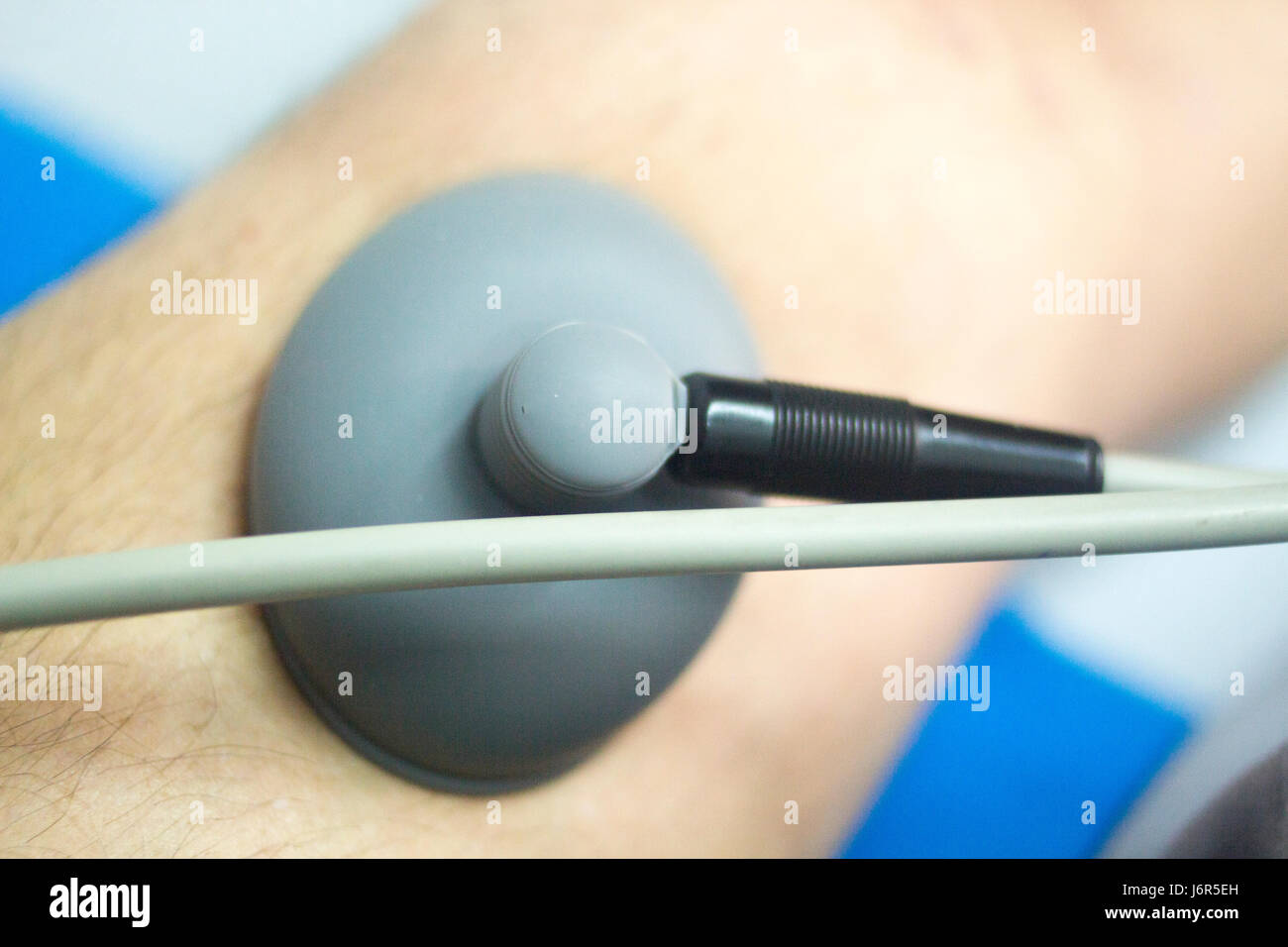 Physical therapy mecical clinic physiotherapy electrical impulse shock treatment for leg injury