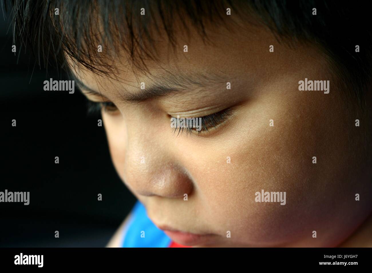 Sunburn Face High Resolution Stock Photography and Images Alamy