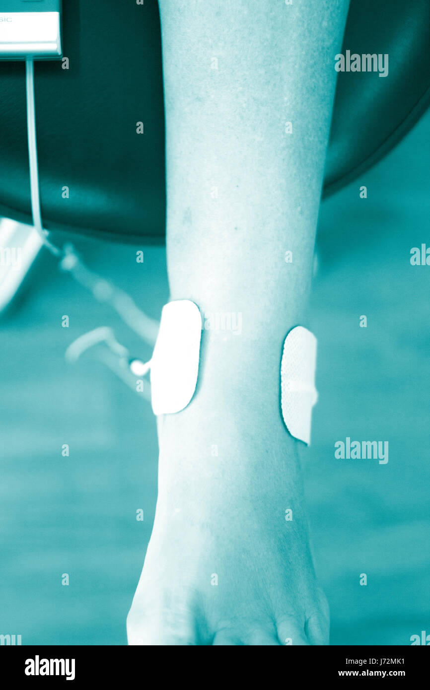 Physical therapy mecical clinic physiotherapy electrical impulse shock treatment for leg injury