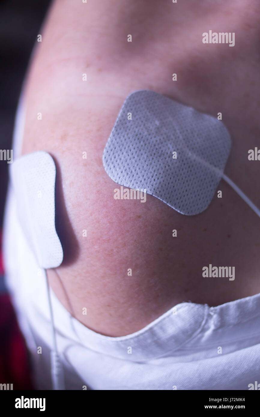 Physical therapy mecical clinic physiotherapy electrical impulse shock treatment for leg injury