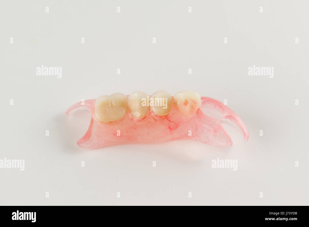 modern nylon removable dental prosthesis for restoring dentition Stock Photo