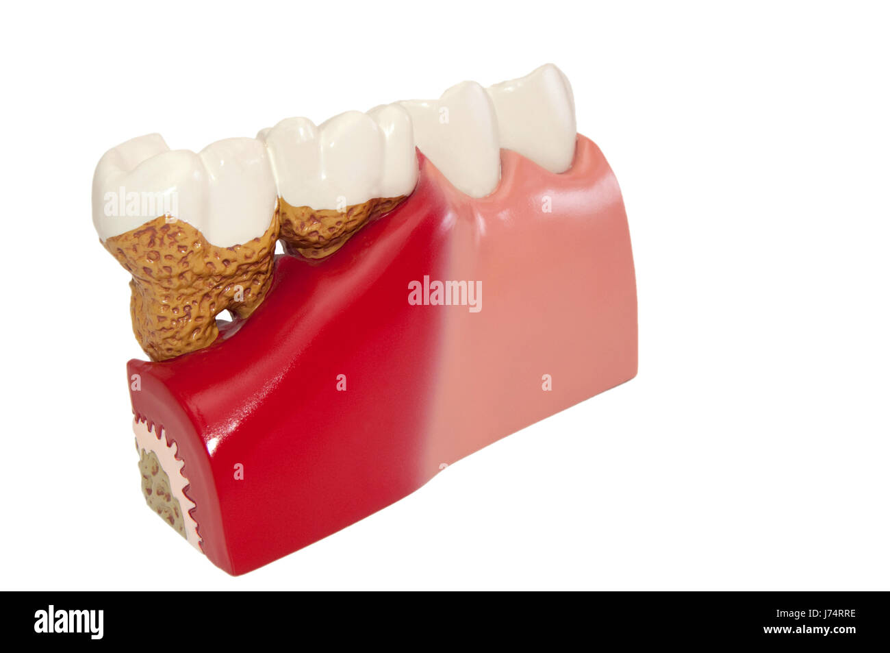 teeth bit dentist crown laboratory dental laboratory optional bridge pine blank Stock Photo