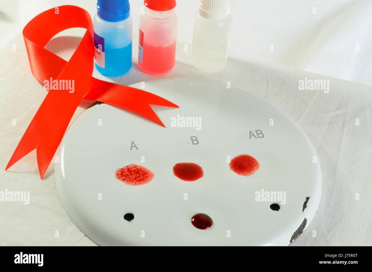 Blood sampling and analysis in a biochemical laboratory on a light ...
