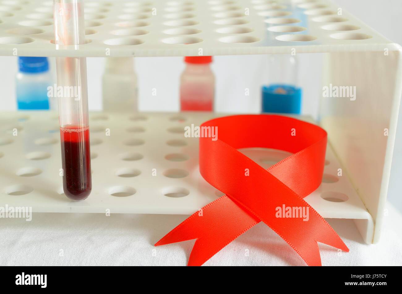 Plasma sampling in laboratory hi-res stock photography and images - Alamy