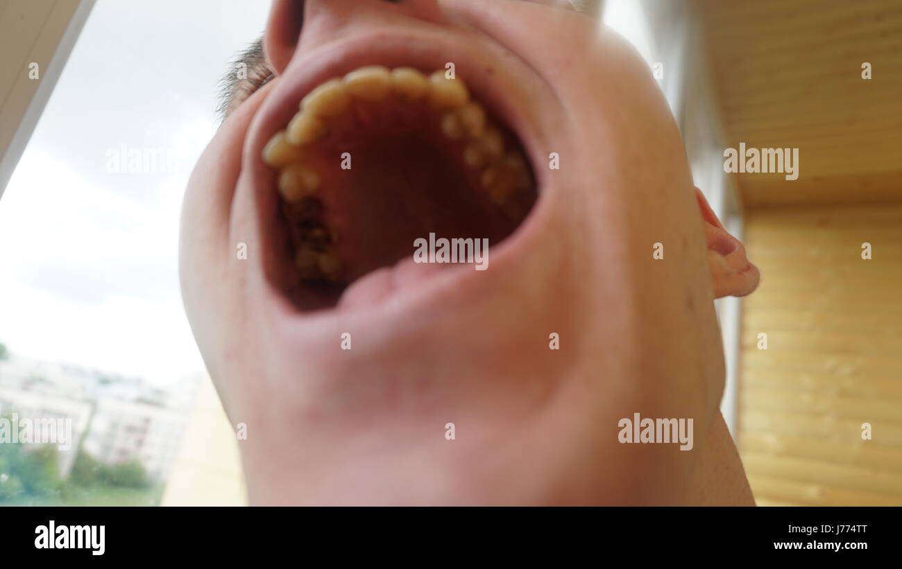 Would you date a guy who is handsome built smart - but has bad teeth