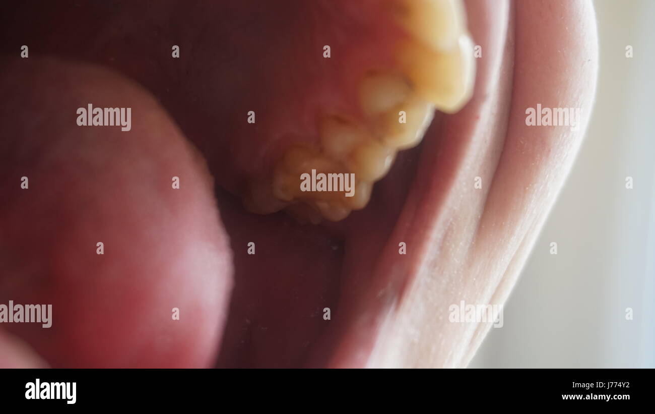 Would you date a guy with yellow teeth
