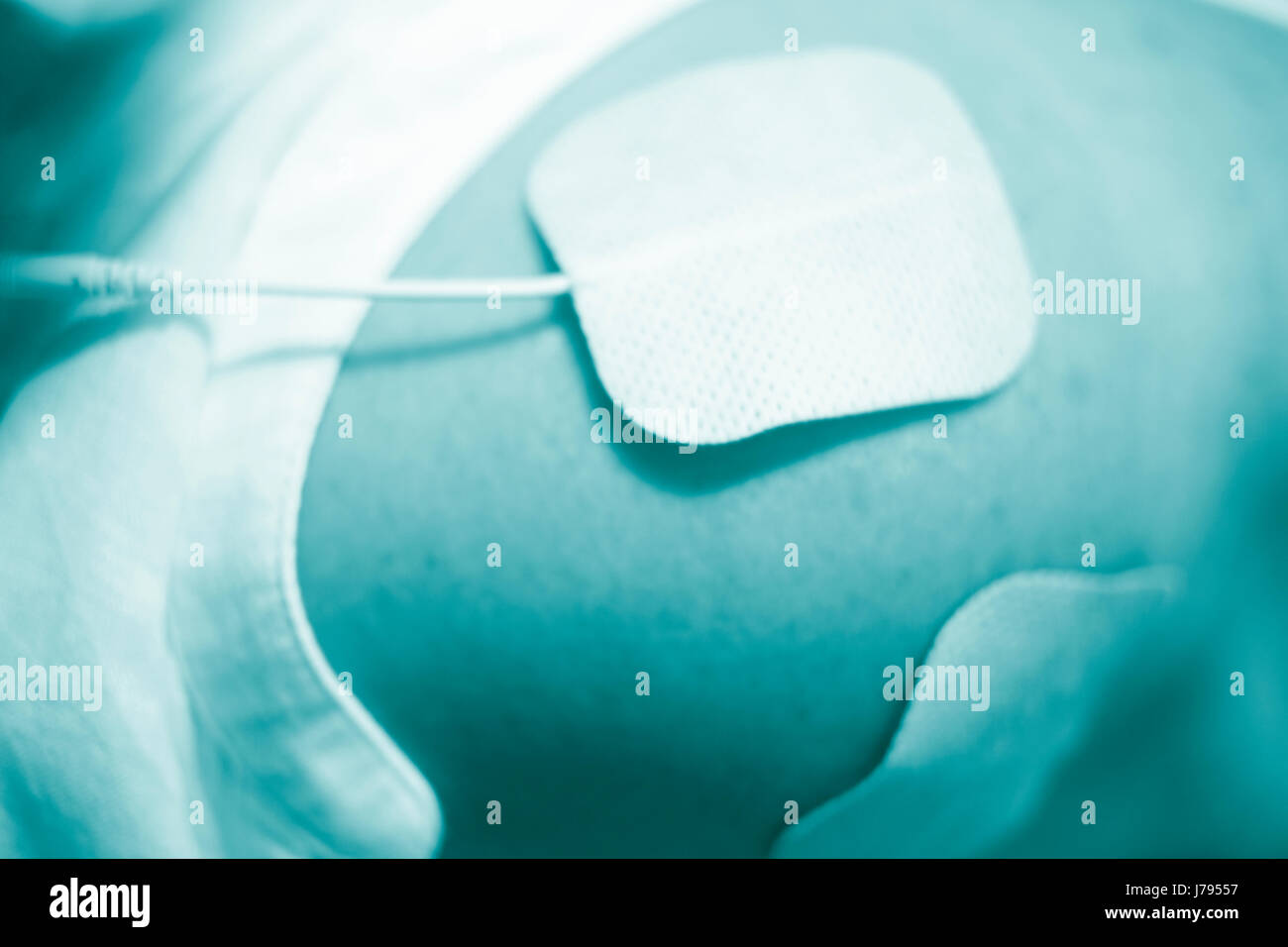 Physical therapy mecical clinic physiotherapy electrical impulse shock treatment for leg injury