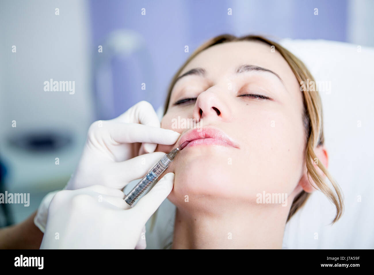 Aesthetic surgery, woman receiving Derma Filler Stock Photo