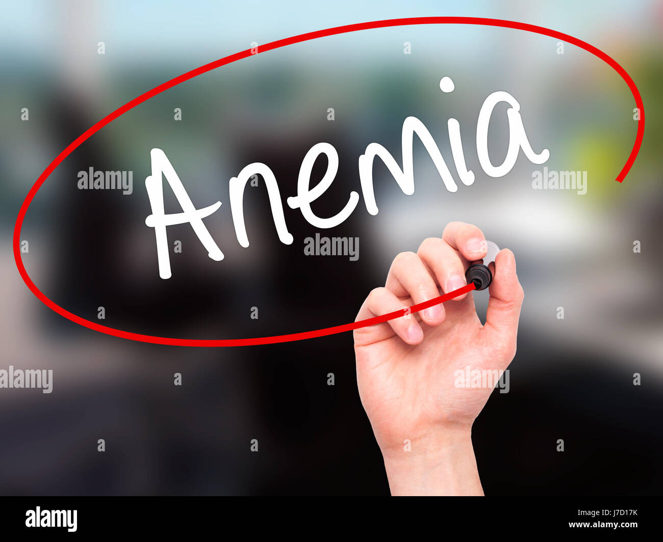 Man Hand writing Anemia  with black marker on visual screen. Isolated on background. Business, technology, internet concept. Stock Photo Stock Photo