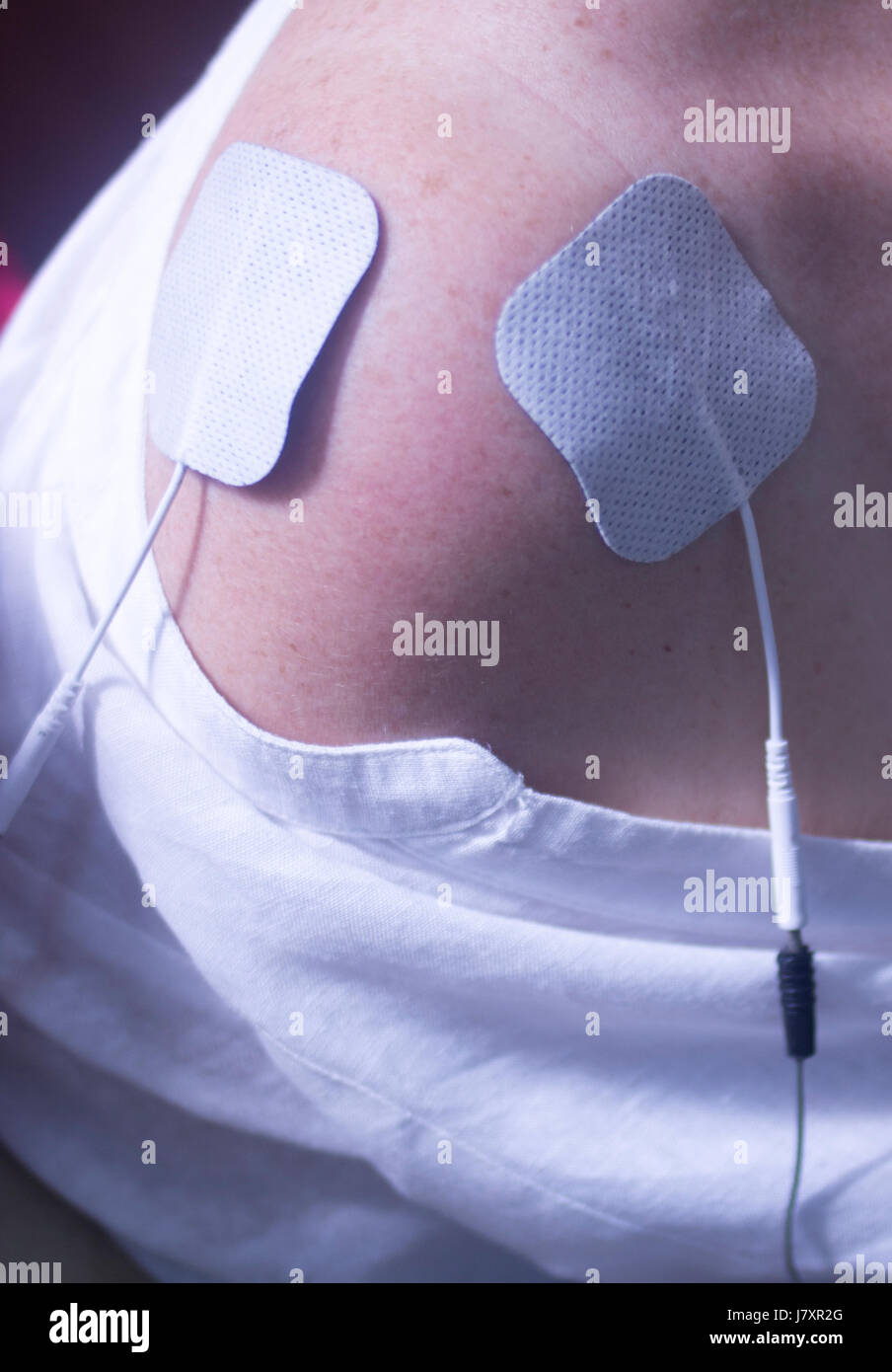 Physical therapy mecical clinic physiotherapy electrical impulse shock treatment for leg injury