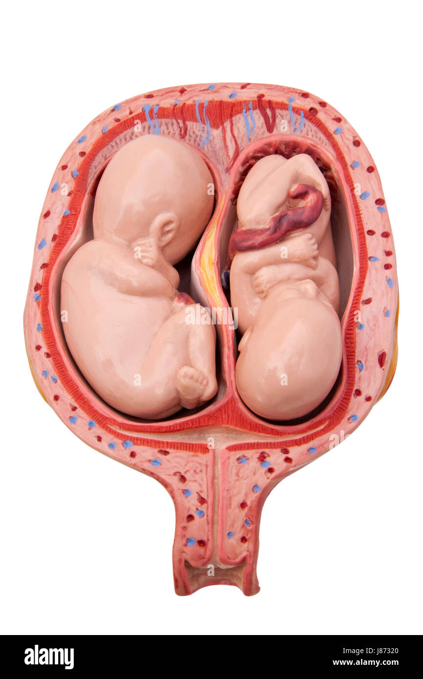 twins, pregnancy, womb, uterus, photo model, model, fetus, gestation, isolated, Stock Photo