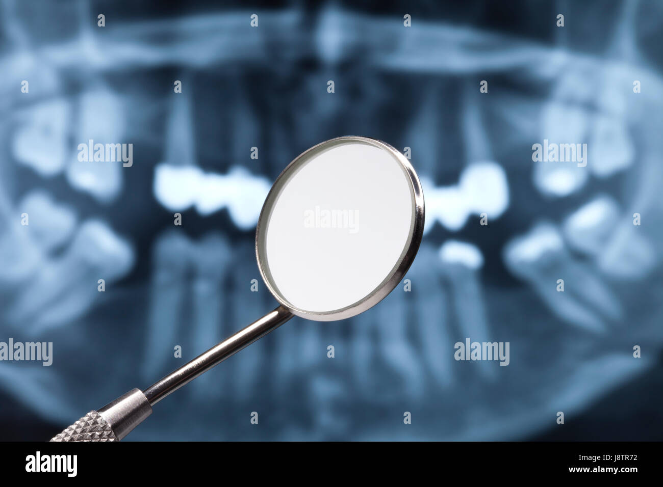 anxiety, stomatoscope, solicitousness, check, dentist, fear, perusal, Stock Photo