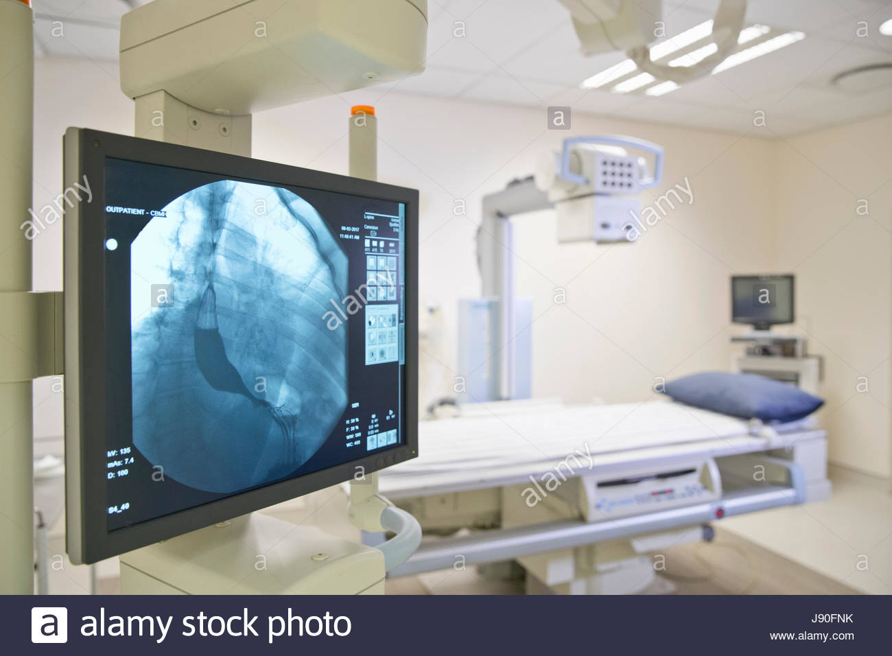 X Ray Department Stock Photos & X Ray Department Stock Images Alamy