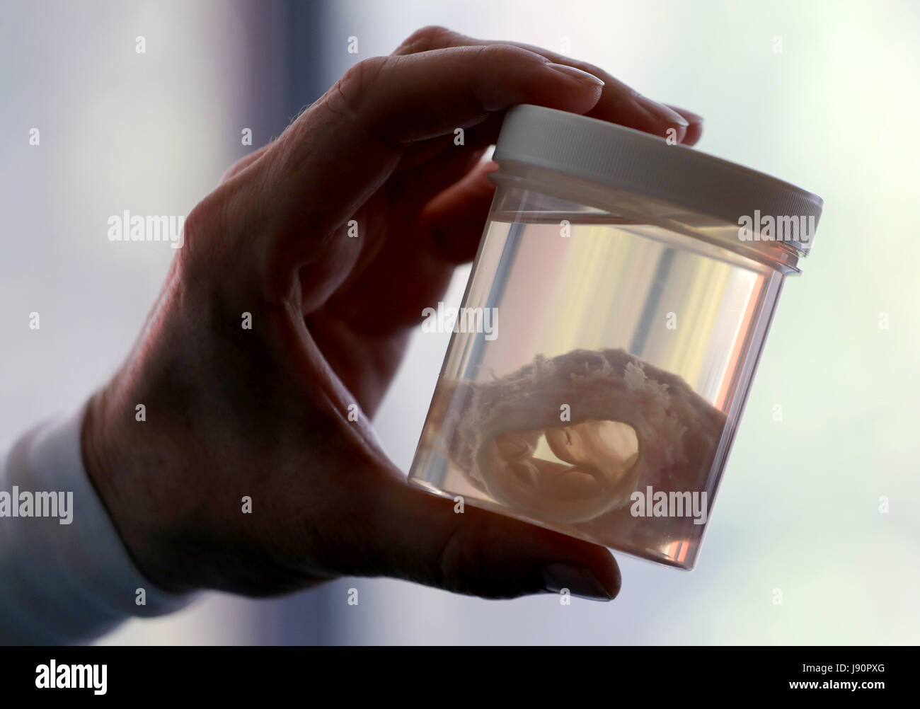 Rostock, Germany. 19th May, 2017. Transplant surgeon FrankPeter