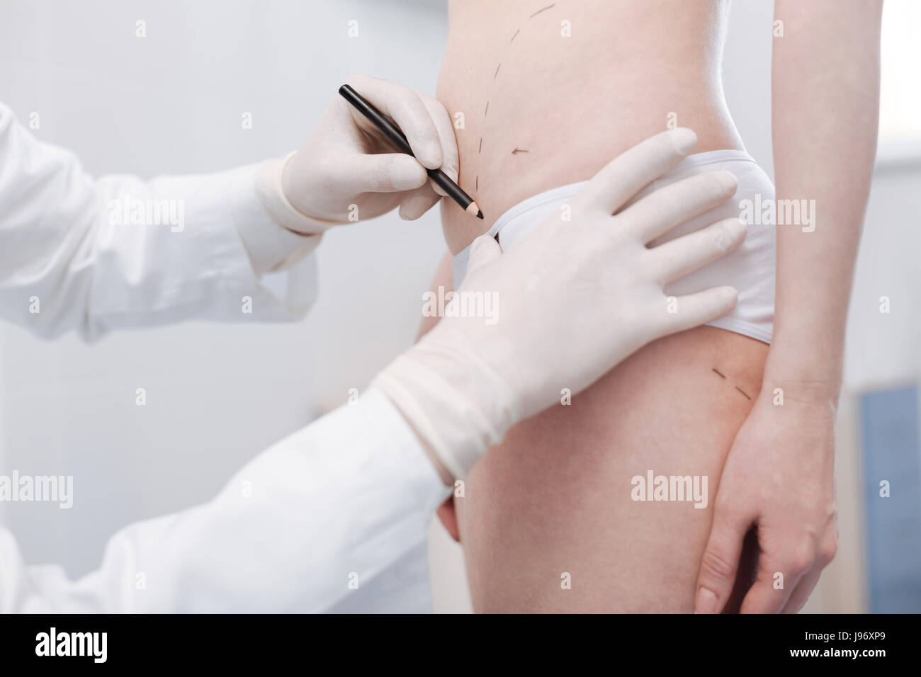 Delicate excellent specialist marking the guidelines for surgery Stock Photo