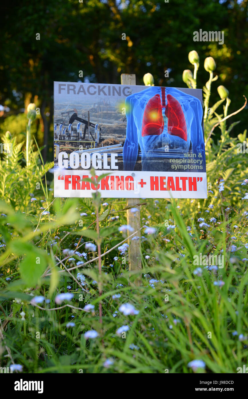 health risk warning sign against fracking in garden in the village of stonegrave ryedale yorkshire united kingdom Stock Photo