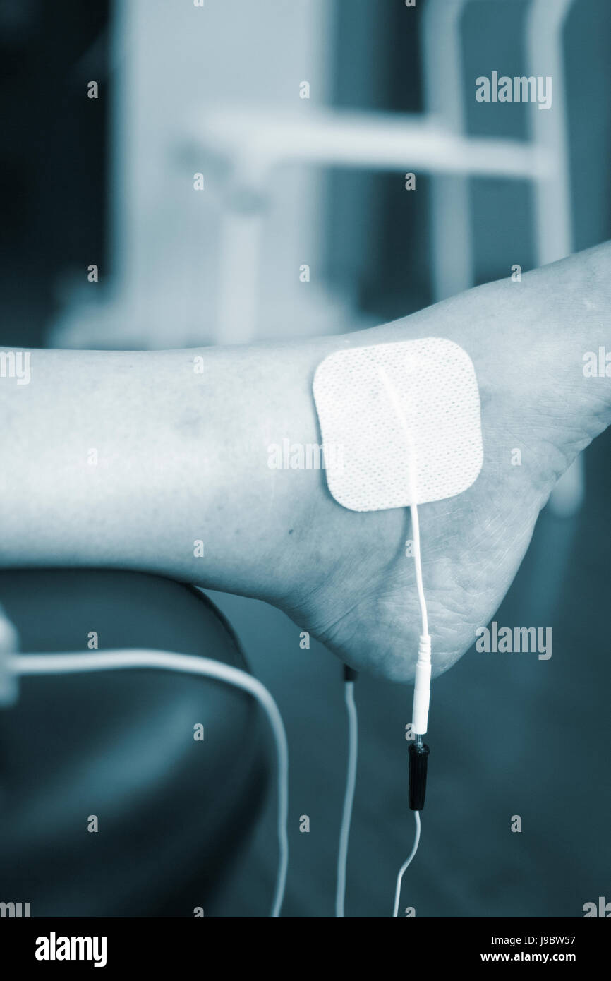 Physical therapy mecical clinic physiotherapy electrical impulse shock treatment for leg injury