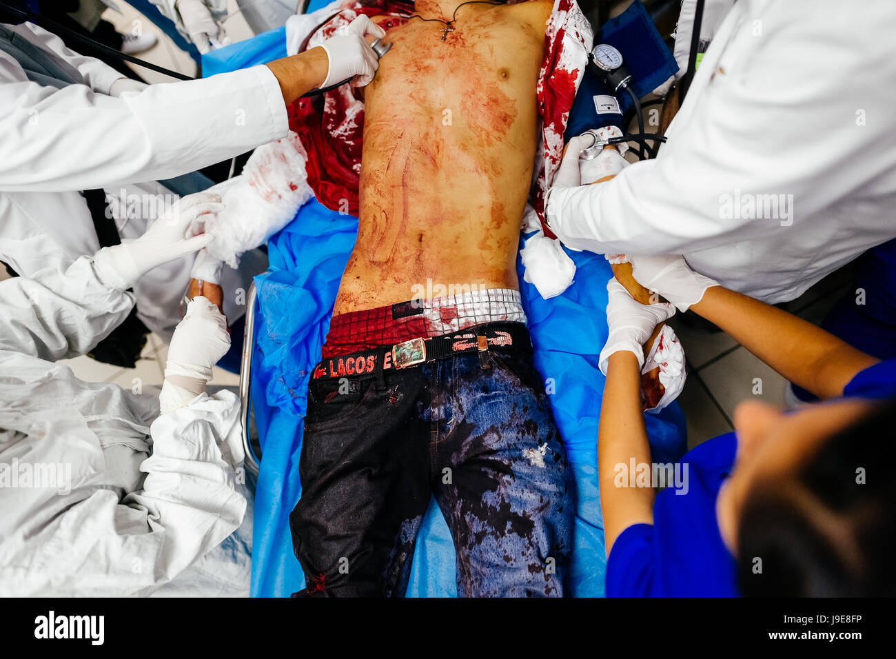 Emergency physicians conduct an acute trauma resuscitation of a young gang member, with three gunshot wounds, in the emergency department of a public hospital in San Salvador, El Salvador, 14 February 2015. Stock Photo