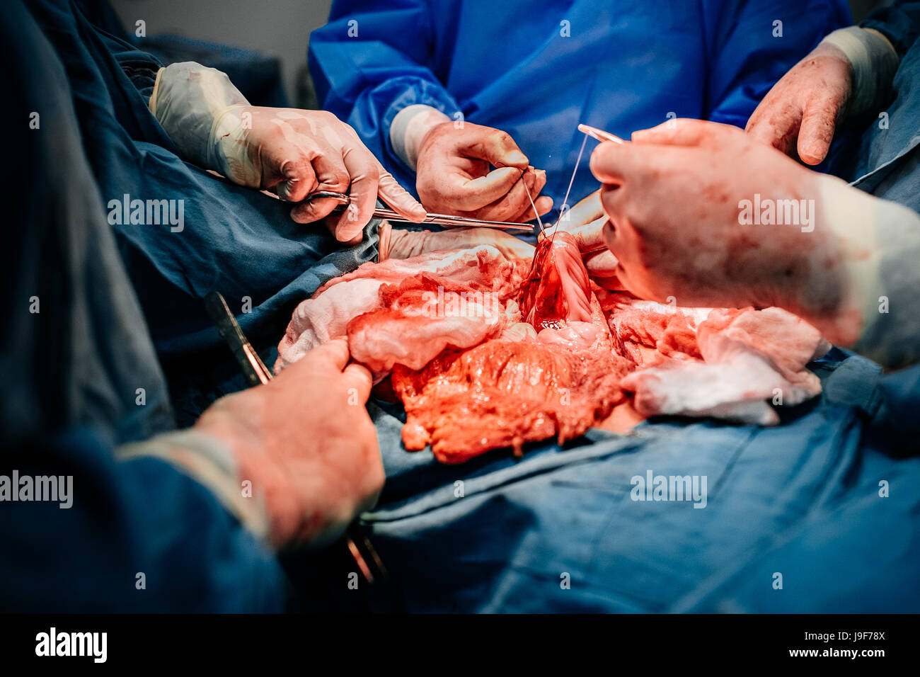 A team of surgeons perform a life-saving surgery on a young gang member, with several gunshot wounds, in the operating room of a public hospital in San Salvador, El Salvador, 16 December 2015. Stock Photo