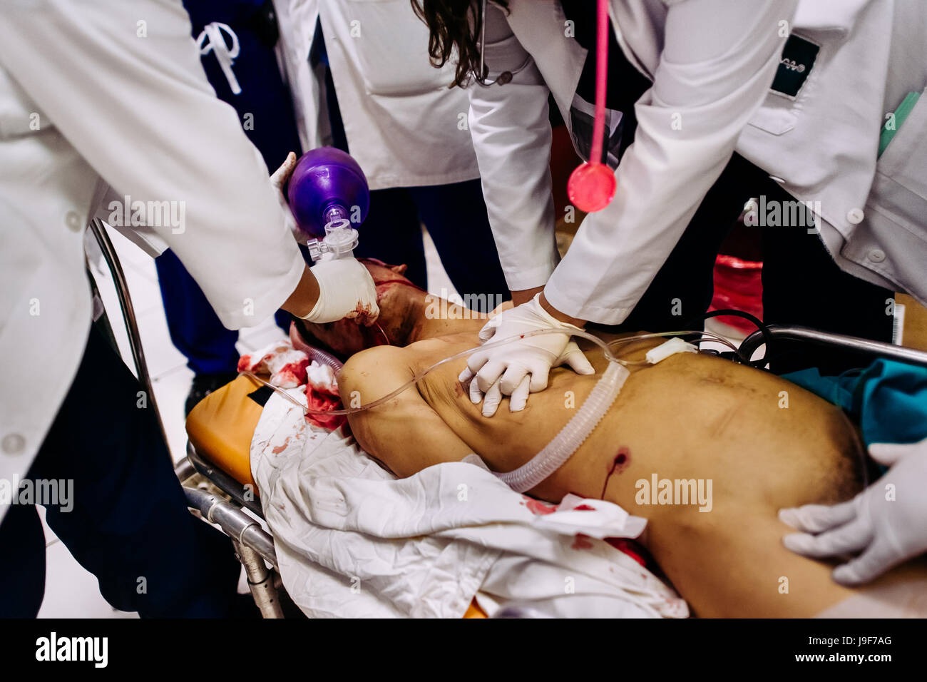 Emergency physicians provide a cardiopulmonary resuscitation to a young gang member, with an abdominal gunshot wound, in the emergency department of a public hospital in San Salvador, El Salvador, 16 December 2015. Stock Photo
