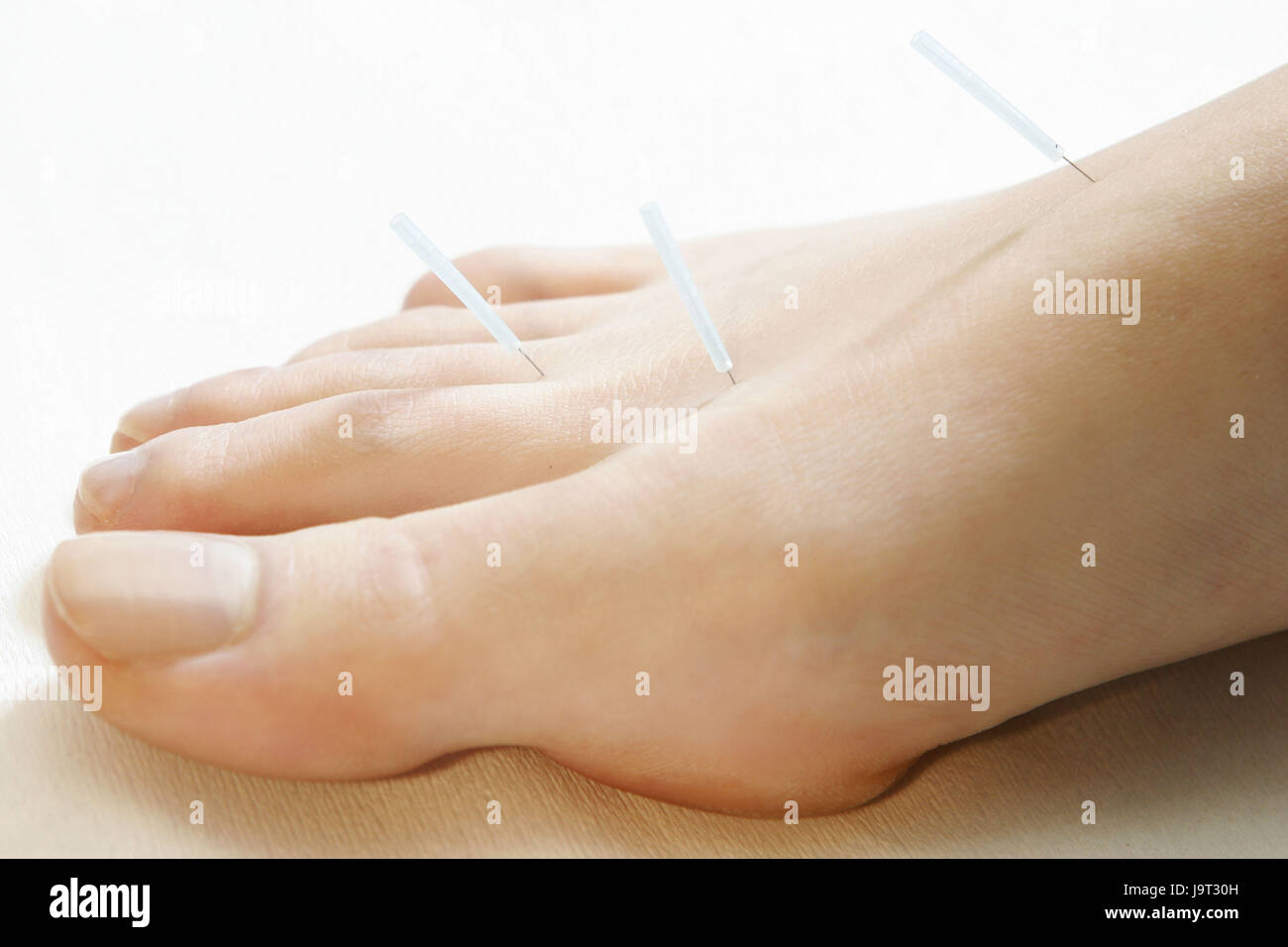 Acupuncture,foot,toes Stock Photo Alamy