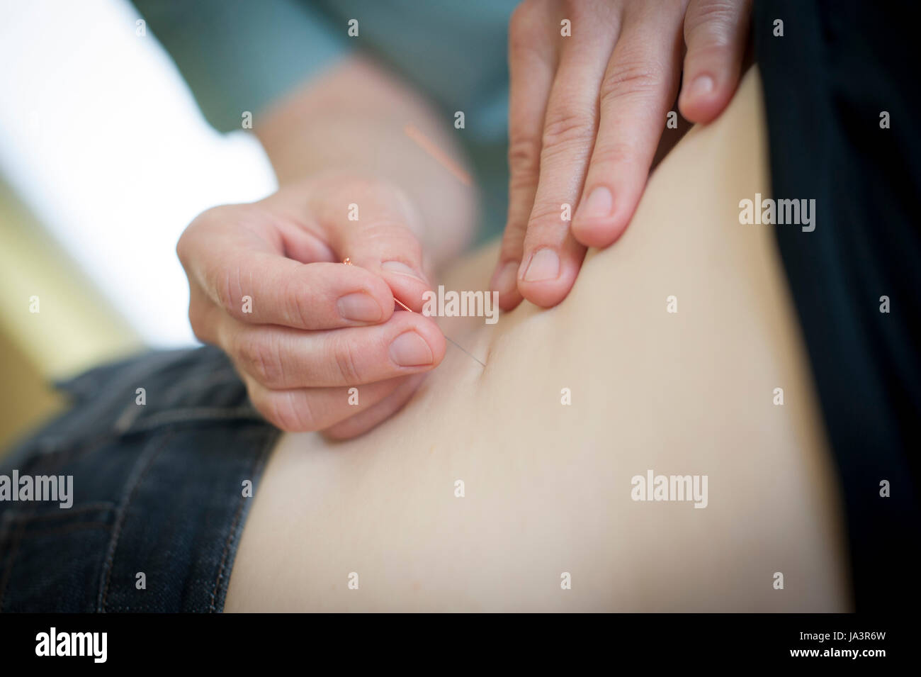Acupuncture in progress at this healing centre. Stock Photo