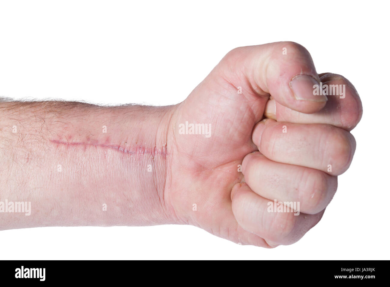 scar, therapy, operation, physiotherapy, operate, orthopedics