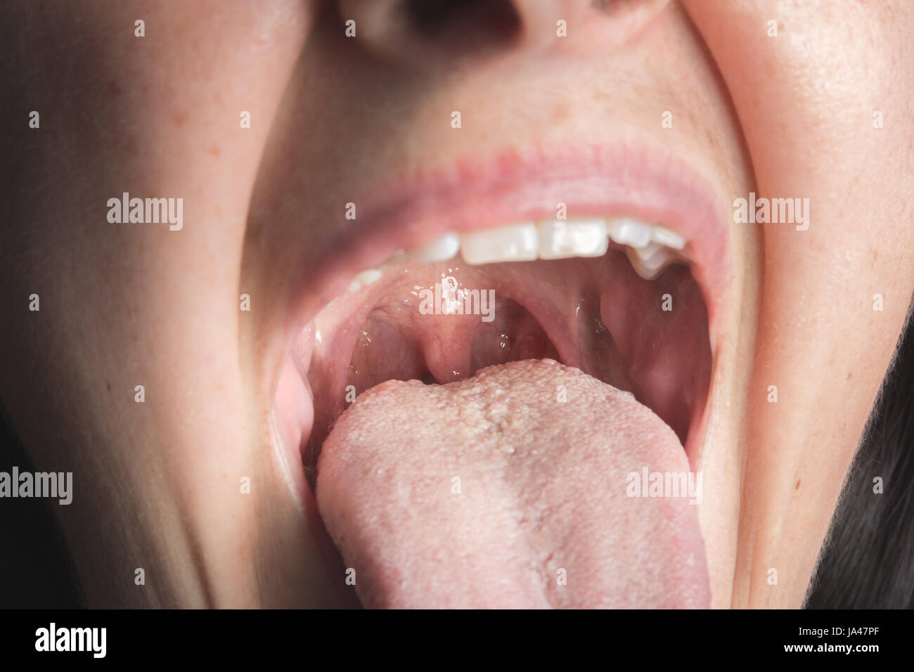 Woman with mouth open to check the palatine uvula Stock Photo