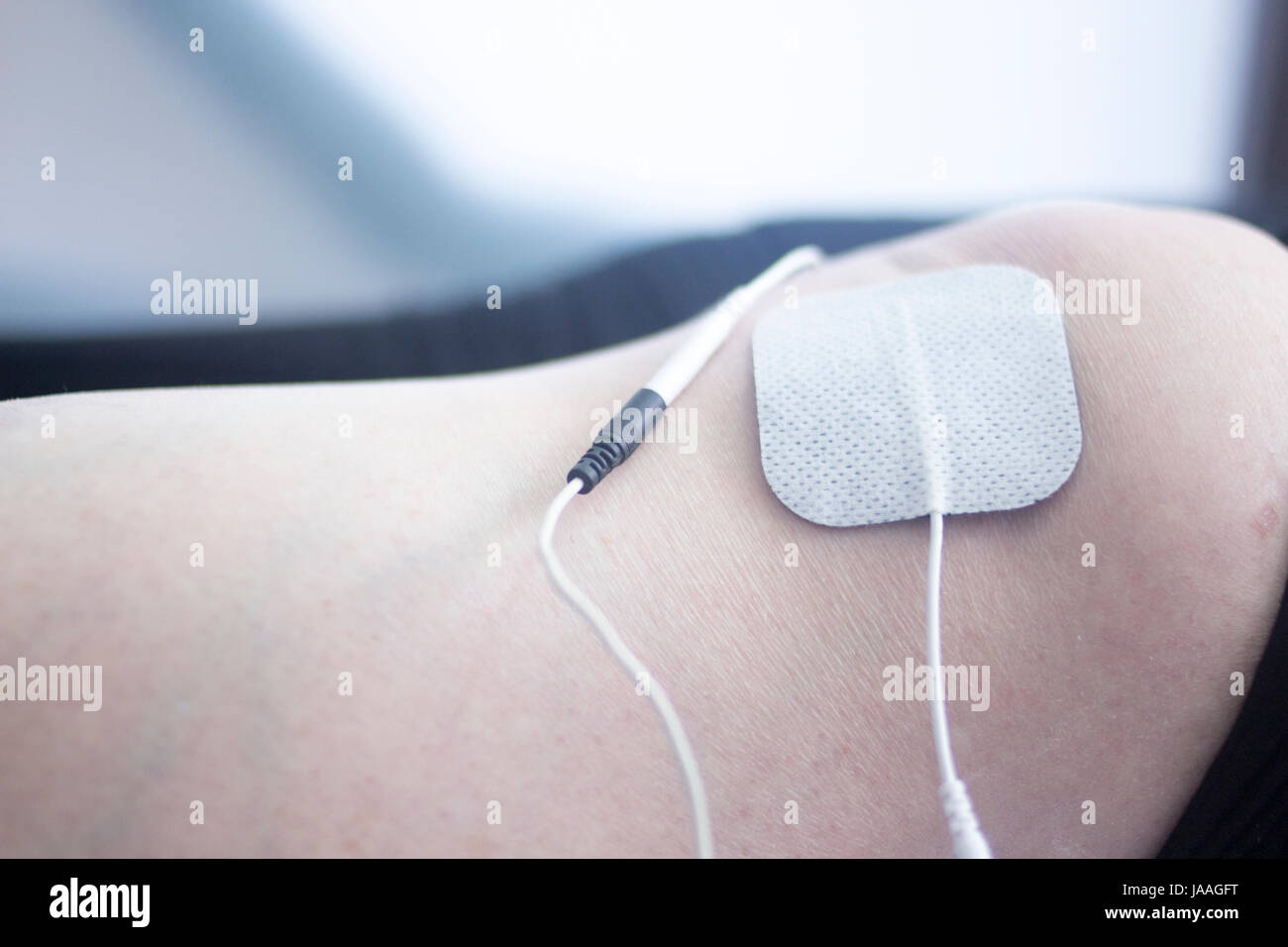 Physical therapy mecical clinic physiotherapy electrical impulse shock treatment for leg injury