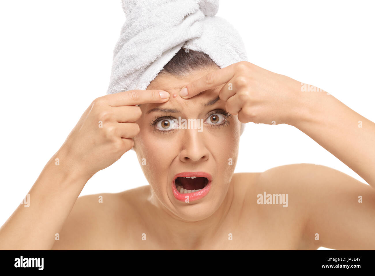 Shocked young woman squeezing a pimple on her forehead isolated on white background Stock Photo