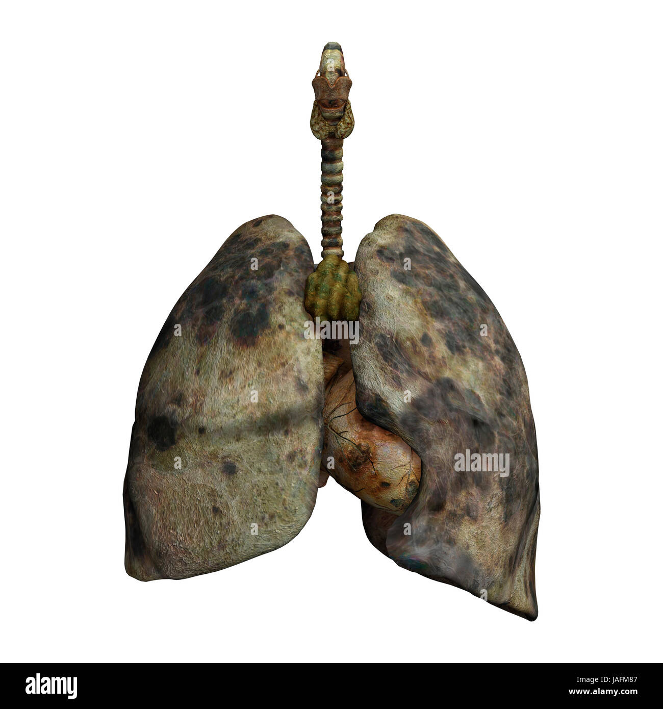 3D digital render of rotten lungs of smokers isolated on white background Stock Photo