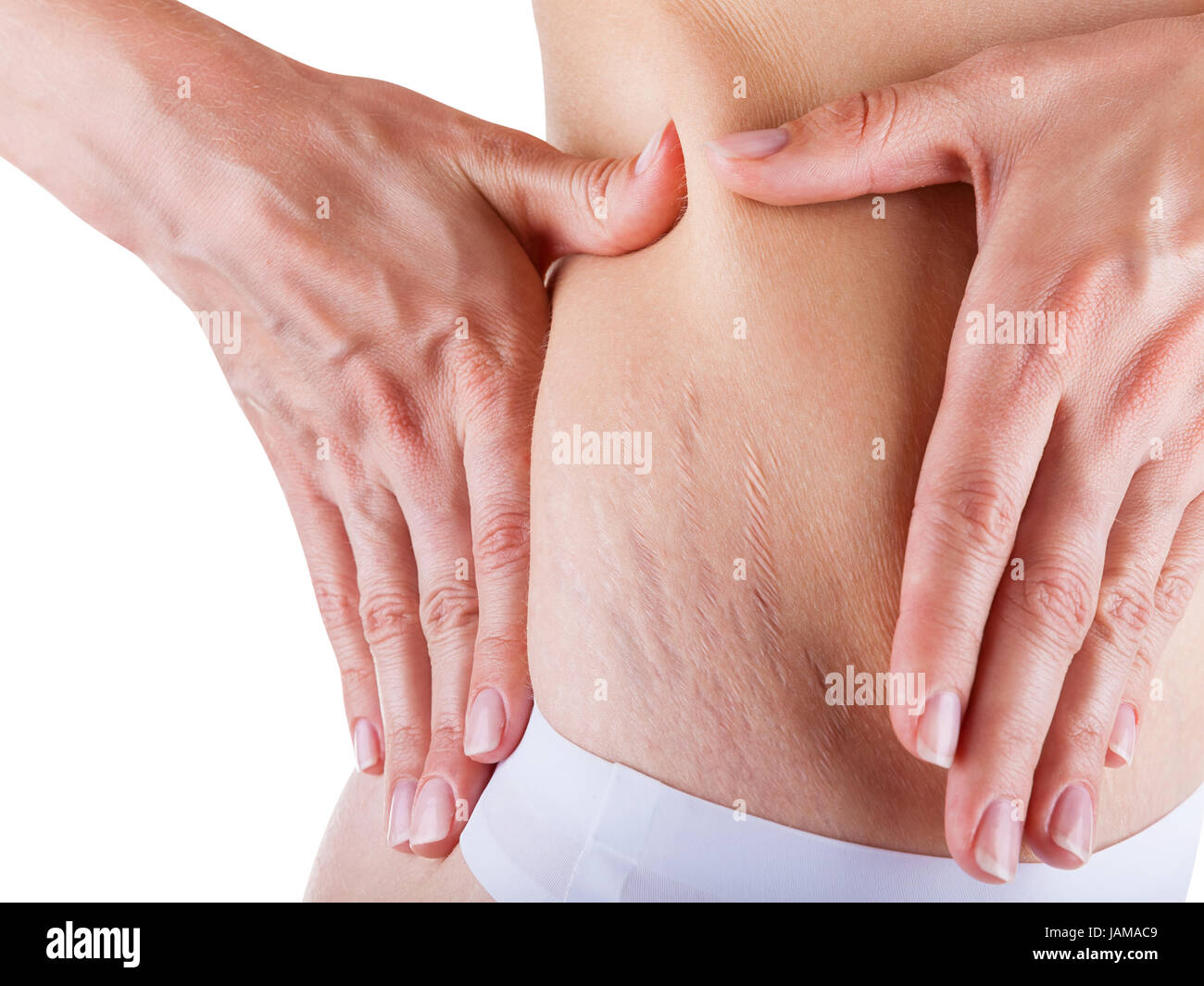 Woman is testing the skin on his stomach on broadly, the presence of stretch marks Stock Photo