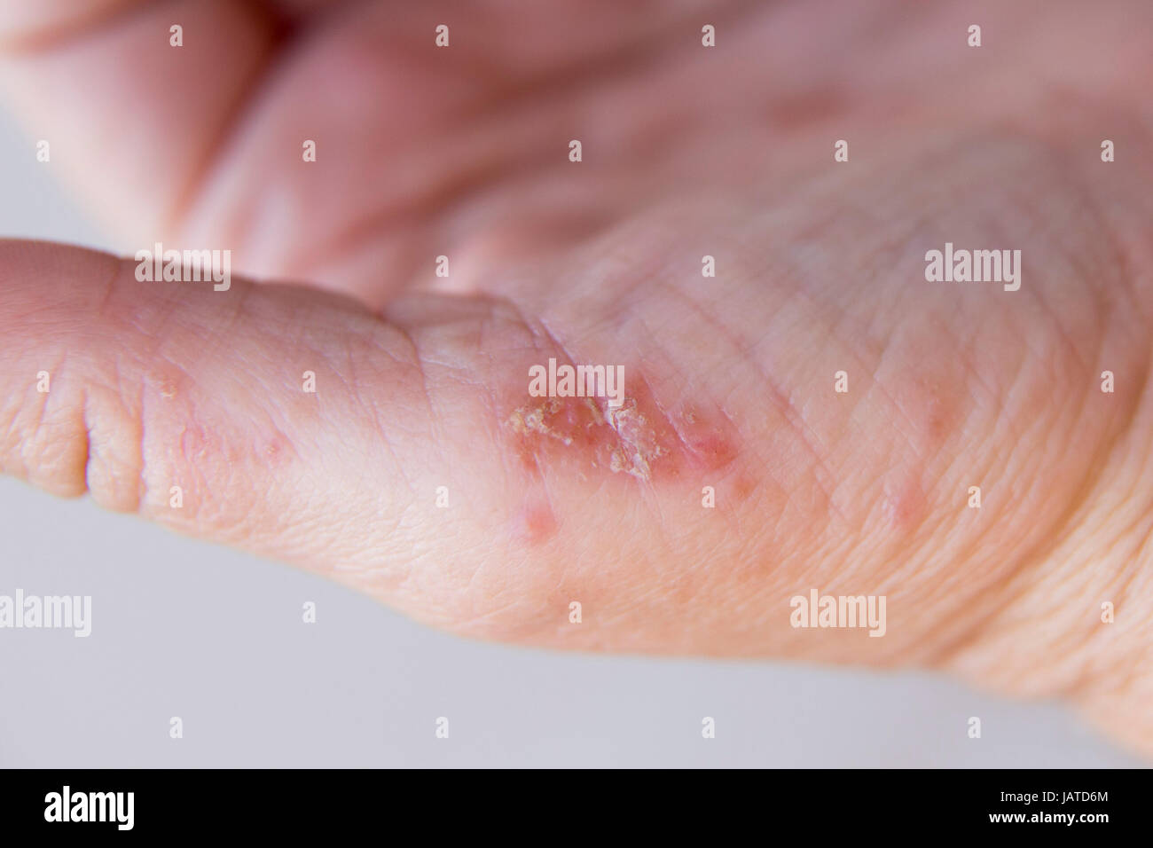 Congratulate, Ear problem in adult question Ear problem in adult something is
