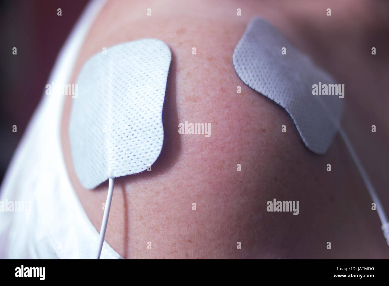 Physical therapy mecical clinic physiotherapy electrical impulse shock