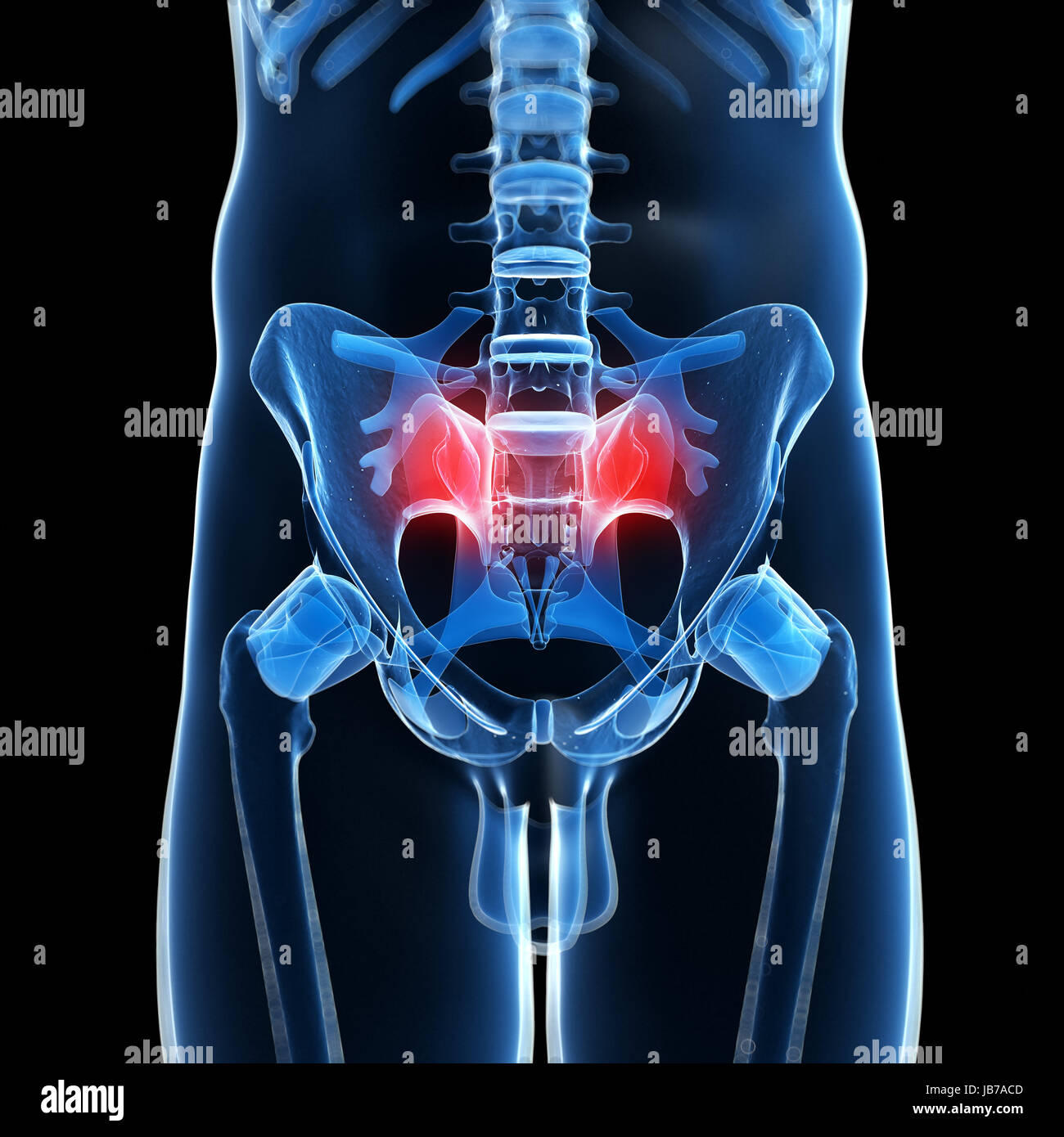 3d rendered illustration of a painful sacrum Stock Photo