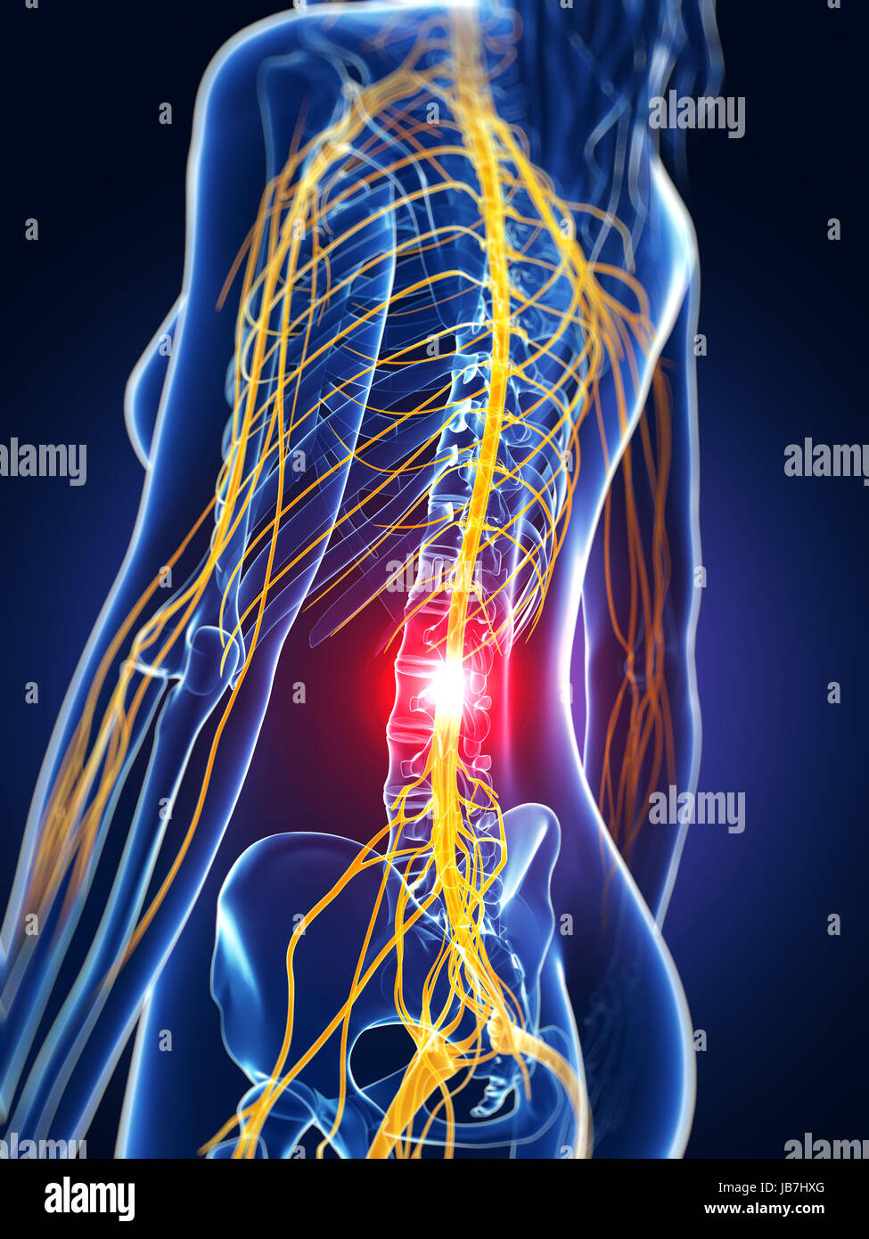 3d rendered medical illustration backache Stock Photo Alamy