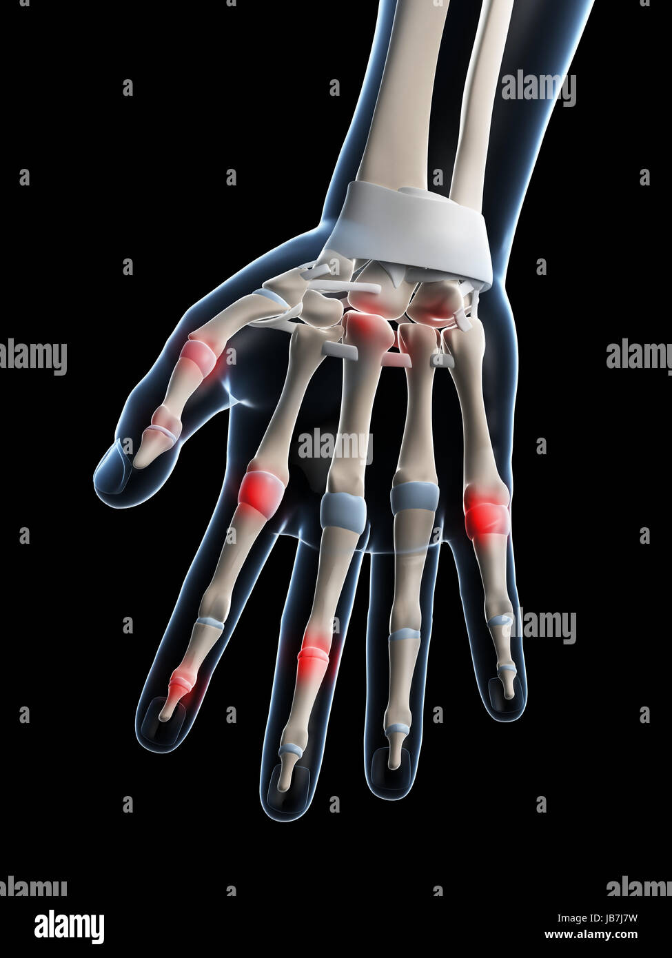3d rendered illustration of painful finger joints Stock Photo Alamy