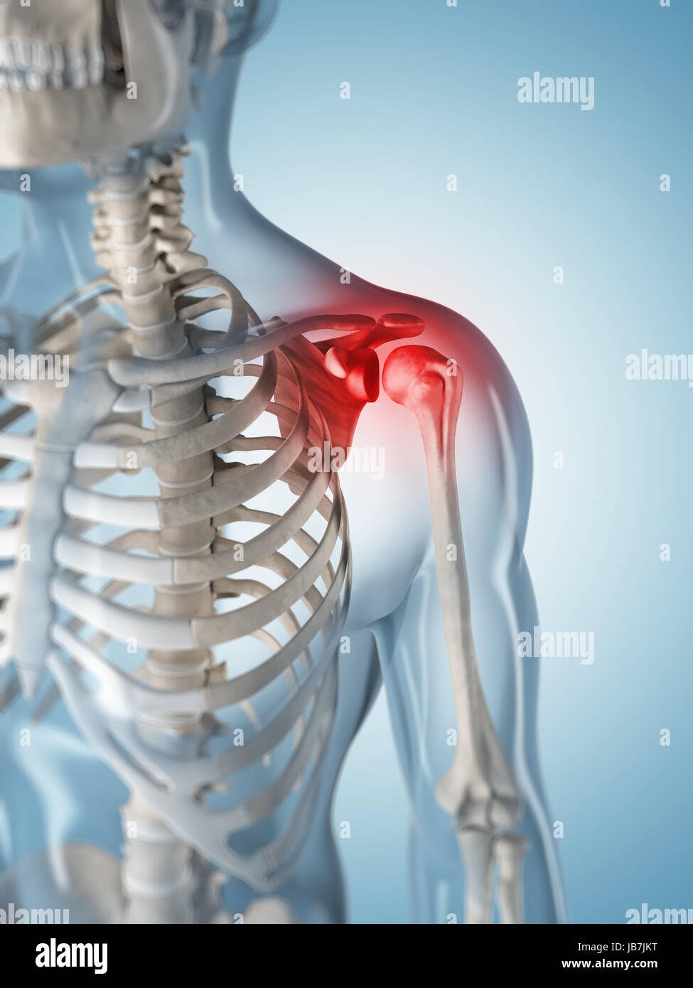 3d rendered illustration of a painful shoulder Stock Photo