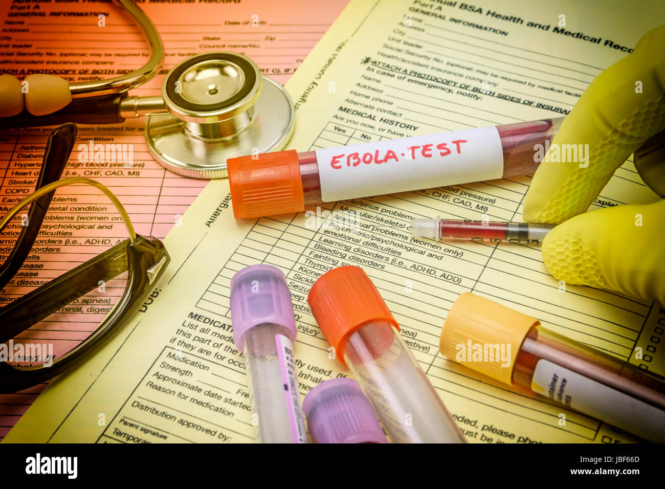 Tests For Research Of Ebola virus Stock Photo