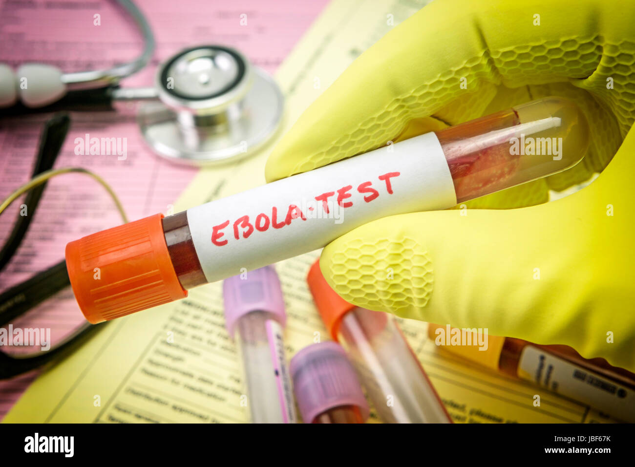 Tests For Research Of Ebola virus Stock Photo