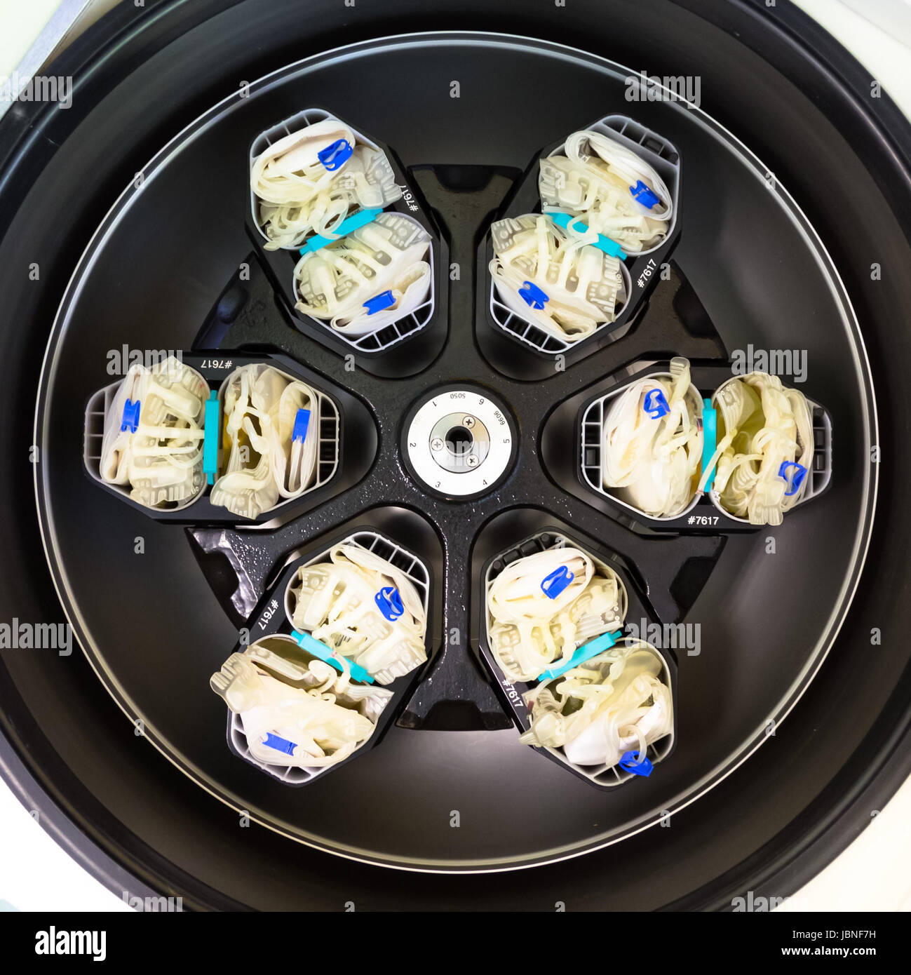 Blood bags after blood donation in centrifuge for separation of serum