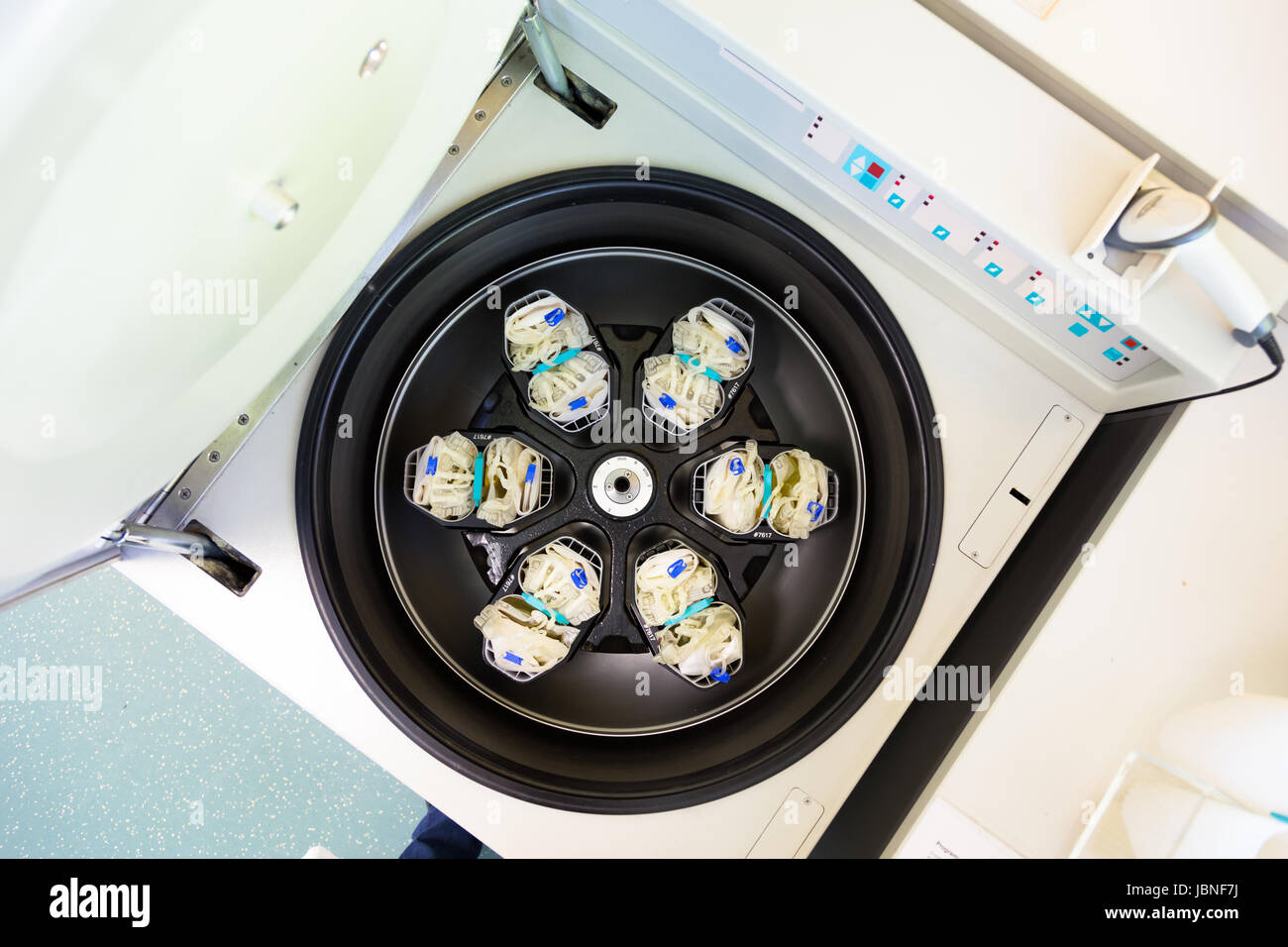 Blood bags after blood donation in centrifuge for separation of serum and red blood cells. Stock Photo