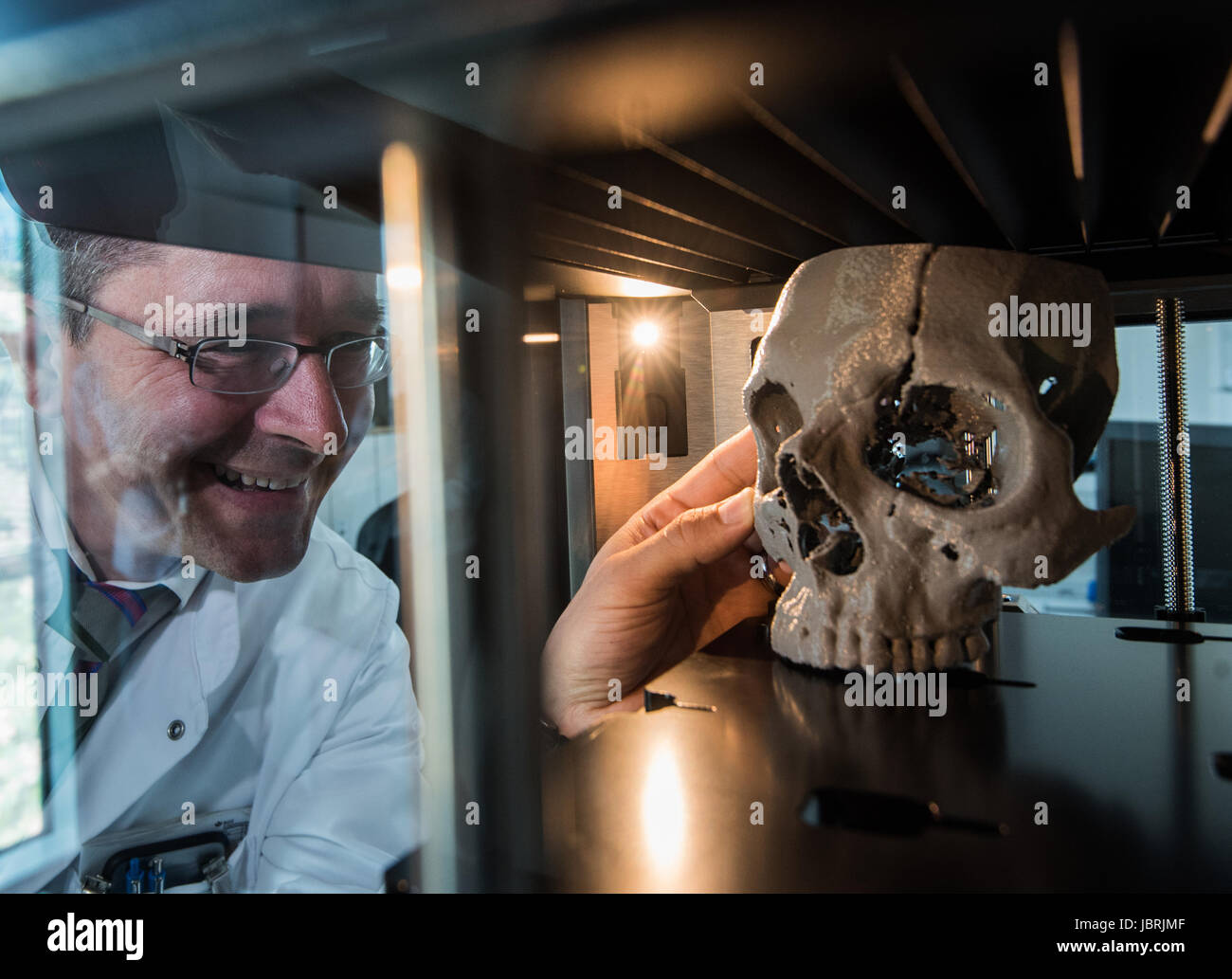 dpatop - The model of a fractured skull is taken from a 3D printer in Frankfurt am Main, Germany, 12 June 2017. The BG Casualty Hospital can now transform two dimensional takes of a computer tomograph into plastic models with the help of a 3D printer. The models are now used for the preperation for operations on complex fractures in bone structures. Photo: Andreas Arnold/dpa Stock Photo