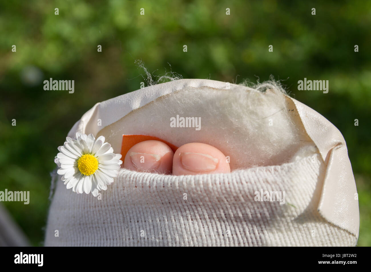 Gipsfuß eines Kindes Stock Photo